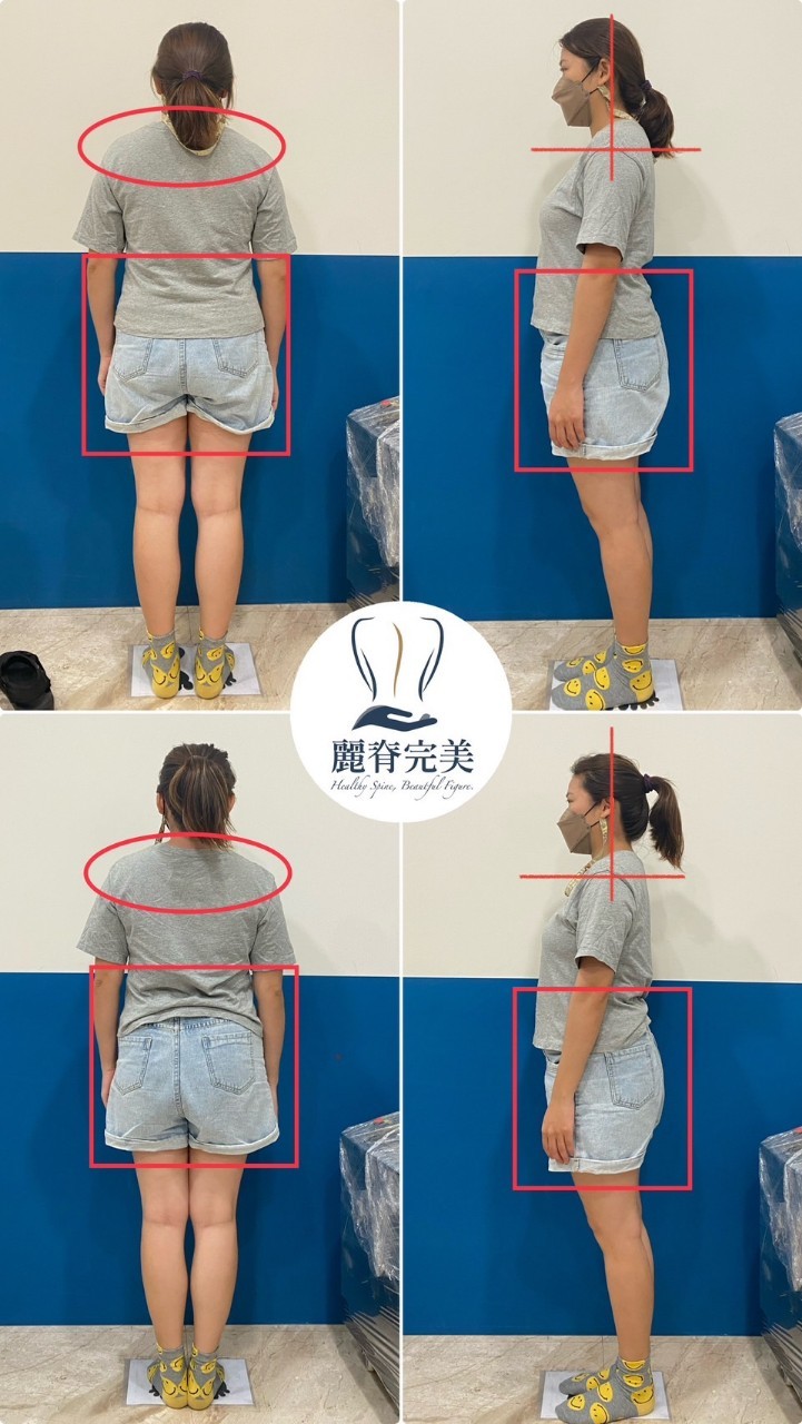 女性骨盆精雕業/郭俊毅/麗脊完美|美式整復全身調理、產後體雕、骨盆調整、腹直肌、淡化頸紋、肋骨外翻,產後媽媽體態改善福音! 女性骨盆精雕業/郭俊毅/麗脊完美|美式整復全身調理、產後體雕、骨盆調整、腹直肌、淡化頸紋、肋骨外翻,產後媽媽體態改善福音!