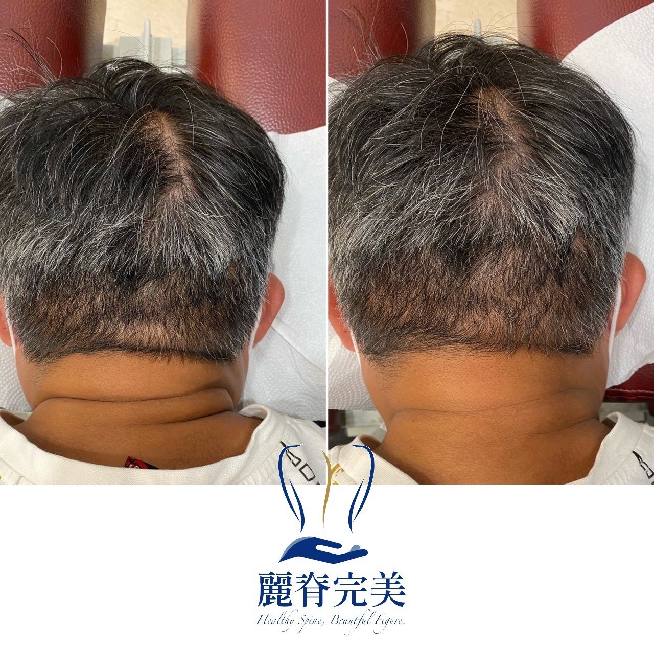 女性骨盆精雕業/郭俊毅/麗脊完美|美式整復全身調理、產後體雕、骨盆調整、腹直肌、淡化頸紋、肋骨外翻,產後媽媽體態改善福音! 女性骨盆精雕業/郭俊毅/麗脊完美|美式整復全身調理、產後體雕、骨盆調整、腹直肌、淡化頸紋、肋骨外翻,產後媽媽體態改善福音!