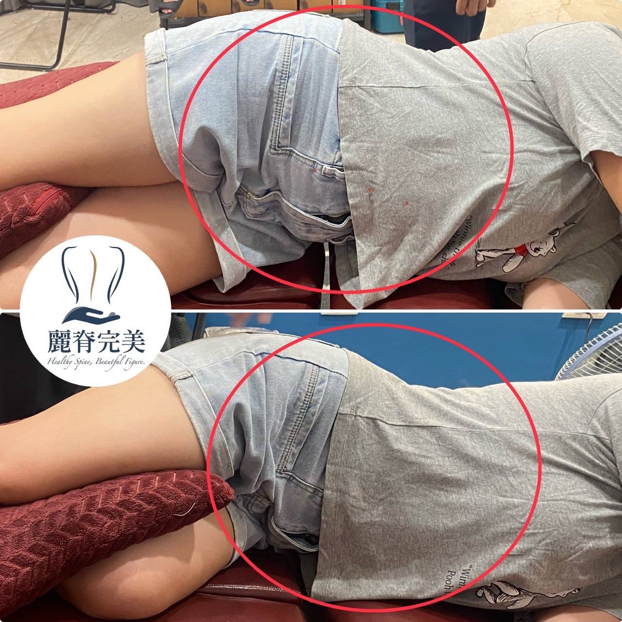 女性骨盆精雕業/郭俊毅/麗脊完美|美式整復全身調理、產後體雕、骨盆調整、腹直肌、淡化頸紋、肋骨外翻,產後媽媽體態改善福音! 女性骨盆精雕業/郭俊毅/麗脊完美|美式整復全身調理、產後體雕、骨盆調整、腹直肌、淡化頸紋、肋骨外翻,產後媽媽體態改善福音!