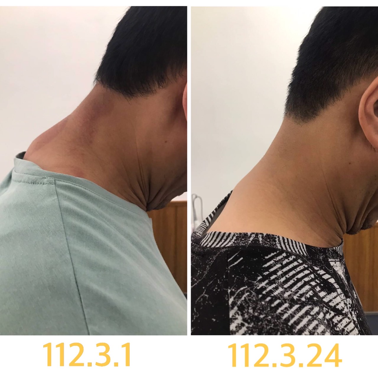 物理治療業/洪健富/一齊好物理治療所|肩頸痠痛、下背痛、椎間盤突出、五十肩、網球肘、退化性關節炎 物理治療業/洪健富/一齊好物理治療所|肩頸痠痛、下背痛、椎間盤突出、五十肩、網球肘、退化性關節炎