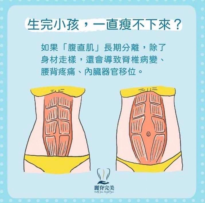 女性骨盆精雕業/郭俊毅/麗脊完美|美式整復全身調理、產後體雕、骨盆調整、腹直肌、淡化頸紋、肋骨外翻,產後媽媽體態改善福音! 女性骨盆精雕業/郭俊毅/麗脊完美|美式整復全身調理、產後體雕、骨盆調整、腹直肌、淡化頸紋、肋骨外翻,產後媽媽體態改善福音!
