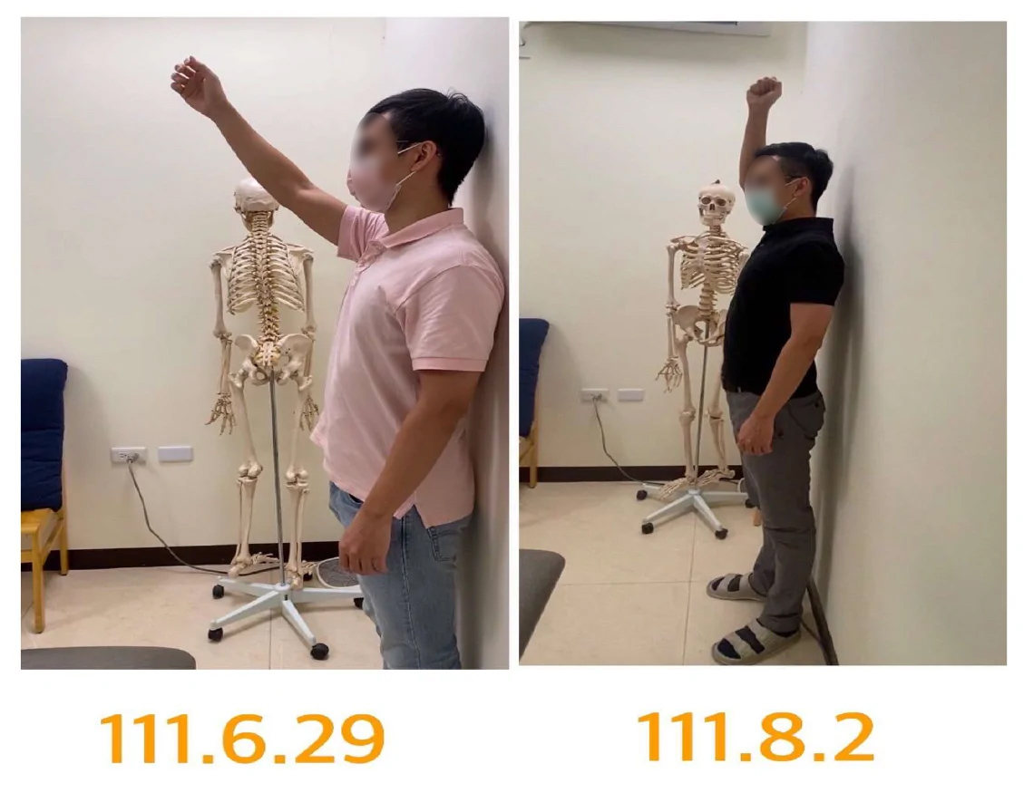 物理治療業/洪健富/一齊好物理治療所|肩頸痠痛、下背痛、椎間盤突出、五十肩、網球肘、退化性關節炎 物理治療業/洪健富/一齊好物理治療所|肩頸痠痛、下背痛、椎間盤突出、五十肩、網球肘、退化性關節炎